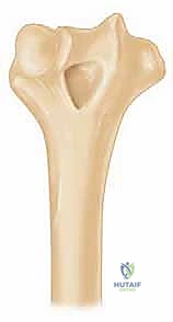 جراحة الكتف بالمنظار 4K