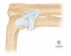 صورة توضيحية لـ تشريح الكتف والجراحة: دليل شامل للمرضى مع الأستاذ الدكتور محمد هطيف في صنعاء