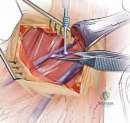 تمارين العلاج الطبيعي للرقبة