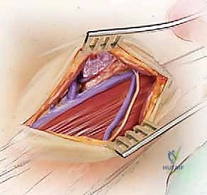 متابعة المريض بعد العملية
