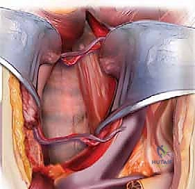 أسباب الانزلاق الغضروفي العنقي