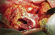 تقييم حالة مفصل الورك في عيادة الدكتور هطيف