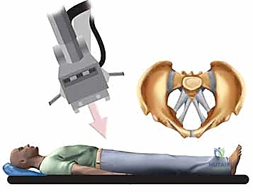 تشريح الحوض البشري المعقد