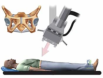 التركيب العظمي الدقيق للحوض