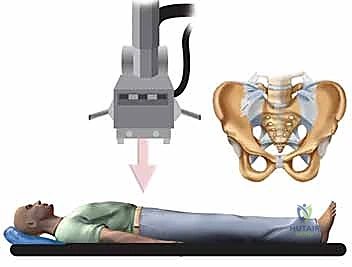 تفاصيل عظام الحوض والأربطة