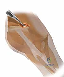 الأوعية الدموية والأعصاب المحيطة بالحوض