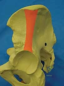 المثبت الخارجي كإجراء لإنقاذ الحياة