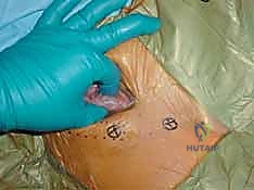 استخدام جهاز الأشعة المرئية أثناء الجراحة