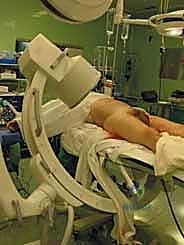 صورة توضيحية لـ التثبيت الخارجي للحوض: دليل شامل للمرضى مع الأستاذ الدكتور محمد هطيف في صنعاء