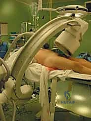 صورة توضيحية لـ التثبيت الخارجي للحوض: دليل شامل للمرضى مع الأستاذ الدكتور محمد هطيف في صنعاء