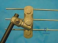 صورة توضيحية لـ التثبيت الخارجي للحوض: دليل شامل للمرضى مع الأستاذ الدكتور محمد هطيف في صنعاء