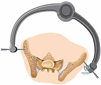 الأستاذ الدكتور محمد هطيف في غرفة العمليات