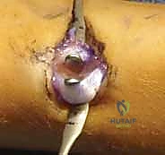 مبدأ عمل المسامير المرنة والتثبيت ثلاثي النقاط