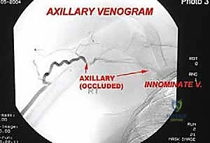 النتيجة التجميلية