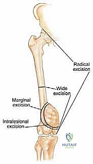 أدوات الجراحة الحديثة