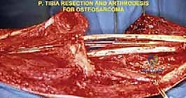 العلاج الطبيعي