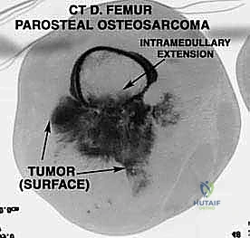 فصل الأوعية الدموية