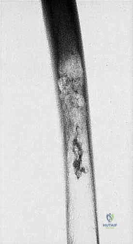 العلاج الكيميائي المتكامل