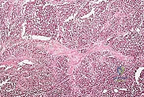 صورة طبية: دليل شامل لاستئصال الساركوما: فهم البيولوجيا، تحديد المراحل، ومبادئ الحفاظ على الأطراف مع الأستاذ الدكتور محمد هطيف