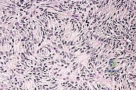 تدريبات المشي