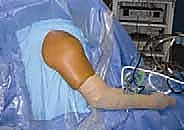 منظار الكتف: دليلك الشامل لفهم الإجراء والتعافي مع الأستاذ الدكتور محمد هطيف