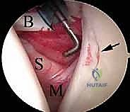 الفحص الدقيق للأنسجة الداخلية