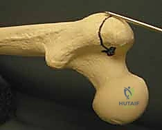 مقارنة بين طرق التثبيت المختلفة