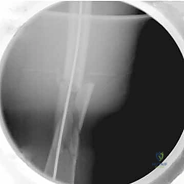 التقييم المستمر لعملية الالتئام العظمي