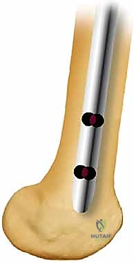 صورة من داخل غرفة العمليات للدكتور هطيف