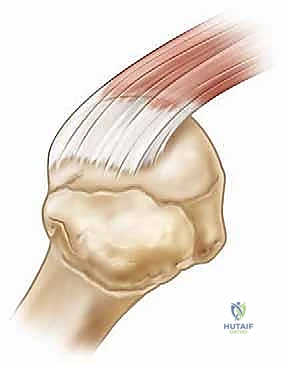 استكشاف مفصل الكتف باستخدام منظار 4K عالي الدقة