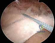 الأستاذ الدكتور محمد هطيف رائد جراحة العظام في اليمن