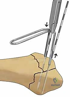 أهمية التقييم الشامل لعوامل الخطر قبل الجراحة