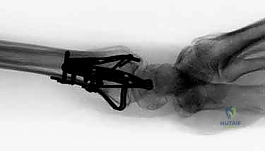 التقييم السريري الدقيق للأعراض في عيادة الدكتور هطيف