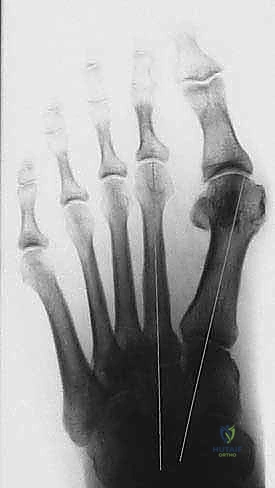 الفحص السريري مع الأستاذ الدكتور محمد هطيف