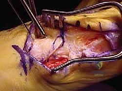 العلاج الطبيعي واستعادة الحركة