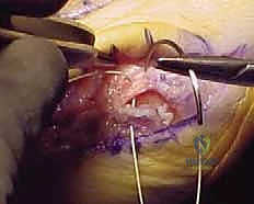 أحدث التقنيات الجراحية في صنعاء