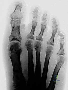 الأستاذ الدكتور محمد هطيف في غرفة العمليات