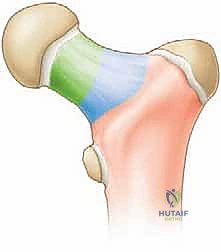 عملية الرد الجراحي