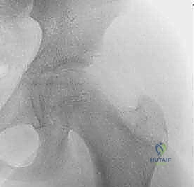 العلاج الطبيعي والتأهيل