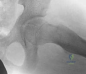 الأستاذ الدكتور محمد هطيف أثناء العمليات