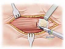التخطيط الجراحي الدقيق