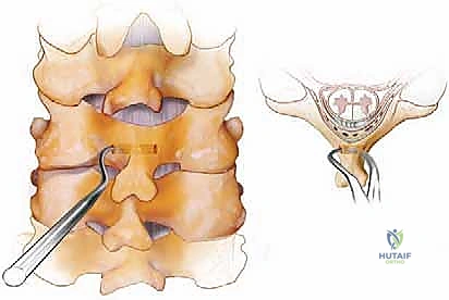 الهياكل الحيوية المحيطة والمخاطر العصبية الوعائية في الرقبة