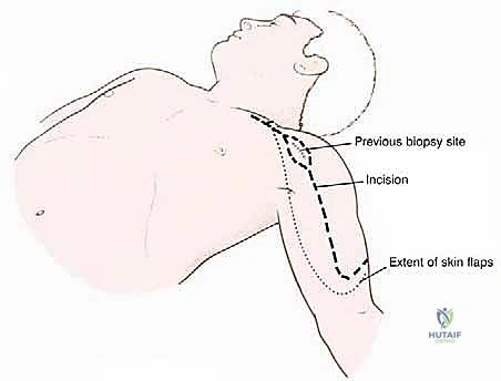 نقاش الخيارات العلاجية مع المريض