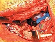 صور الأشعة المقطعية ثلاثية الأبعاد للتخطيط الجراحي