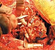 فحص المريض وتقييم قصر الطرف والعرج