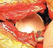 وضعية المريض والتجهيز للعملية