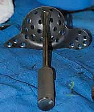 تنظيف التجويف الحقي وتحضيره للترقيع