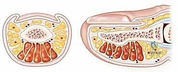 مراحل تطور التهاب الداحس وتجمع الصديد