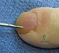 صورة تبرز الفروق التشريحية بين مناطق الإصابة