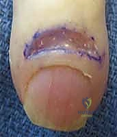 الأستاذ الدكتور محمد هطيف يفحص صور الأشعة لمريض مصاب بالتهاب متقدم